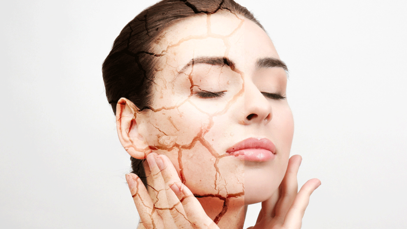 متخصصین اسپا روش‌های کار با پوست خشک را به اشتراک می‌گذارند