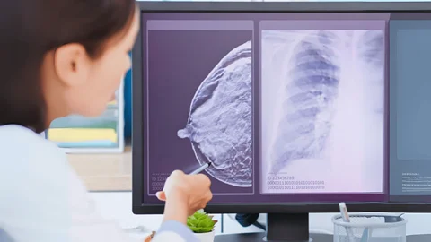 روش نوین تشخیص سرطان با حسگر الماس؛ جایگزینی ایمن برای ردیابهای رادیواکتیو